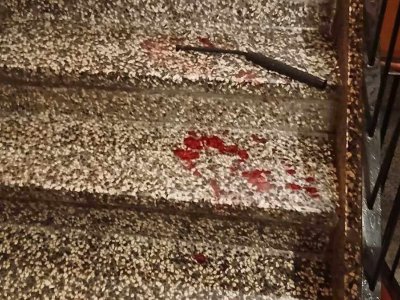 U Sarajevu pretukli muškarca palicama na ulazu u zgradu